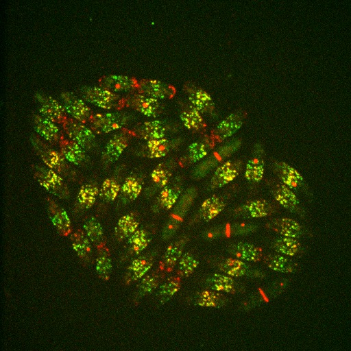 Fluorescence image of rod-shaped fission yeast cells expressing fluorescent markers for two types of nodes. 